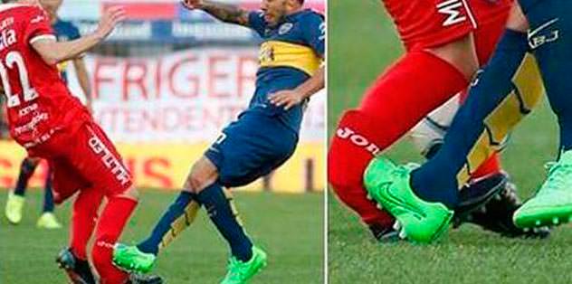 Carlos Tevez ayak kırdı